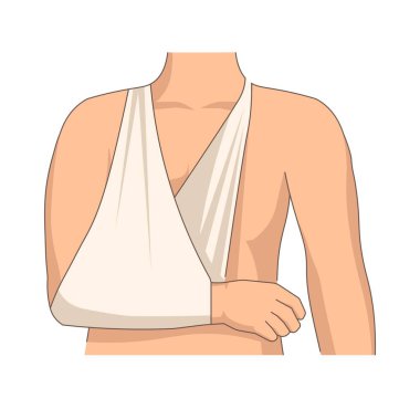 El yaralanması bandajı kırık kol bandajı tıbbı izole edilmiş vektör insan vücudu sağlık ve tedavi kırığı veya kas burkulması ağrısı ilk yardım hastası travması terapisi