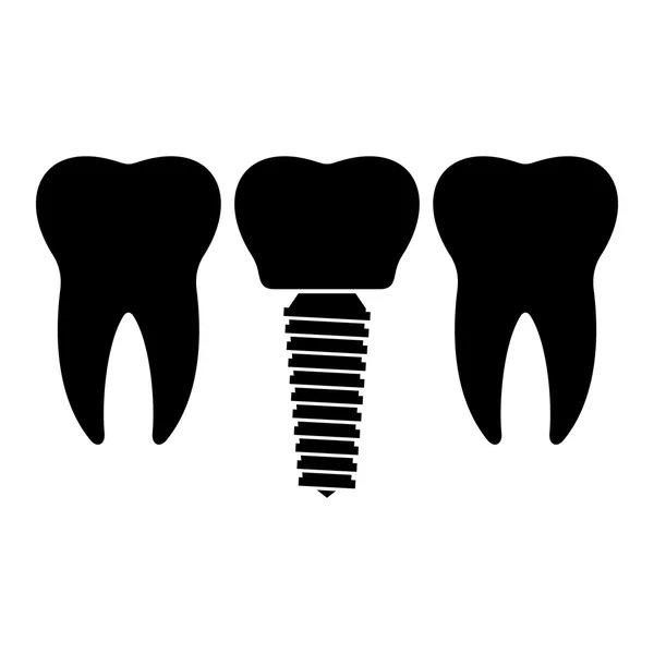 Набір зубних імплантатів — стоковий вектор