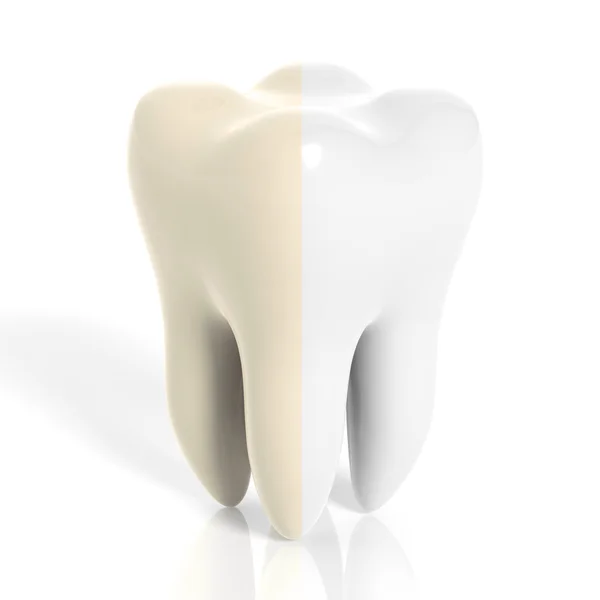 Dente molar branco e amarelo isolado no fundo branco — Fotografia de Stock