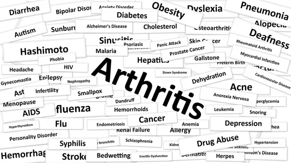 Artrit denen bir hastalık