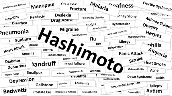 Hashimoto denen bir hastalık