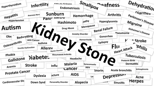 Uma doença chamada Pedra do Rim — Fotografia de Stock