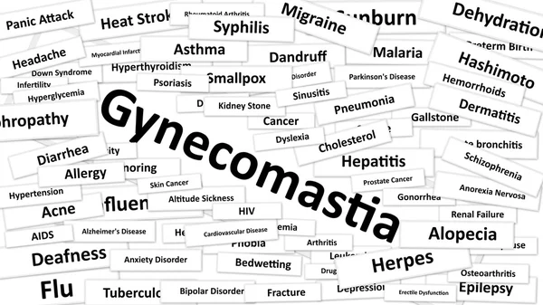 Egy betegség, az úgynevezett Gynecomastia — Stock Fotó