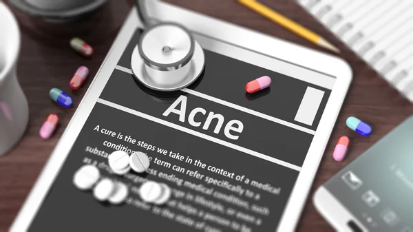 Tablet met "Acne" op het scherm, stethoscoop, pillen en objecten op houten bureaublad. — Stockfoto