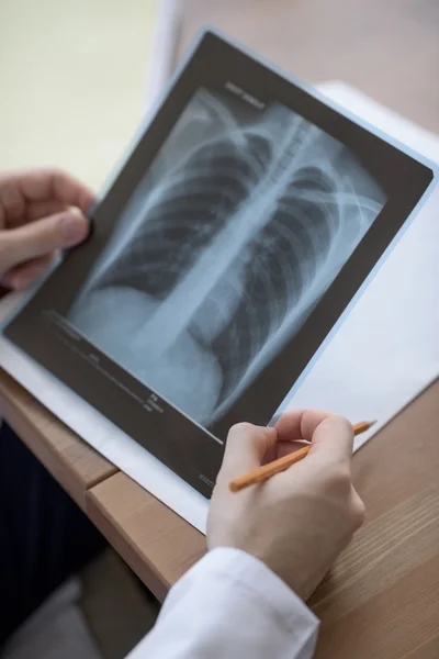 Läkare händer som håller xray — Stockfoto