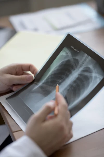 Médico segurando raio-x — Fotografia de Stock