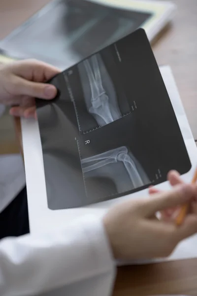 Doctor examining an elbow x-ray — Stock Photo, Image