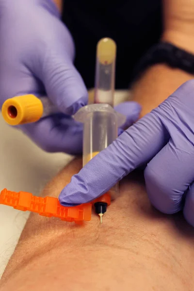 Blood Draw Phlebotomist Draws Patients Blood Blood Test Doctor Drawing — Stock Photo, Image