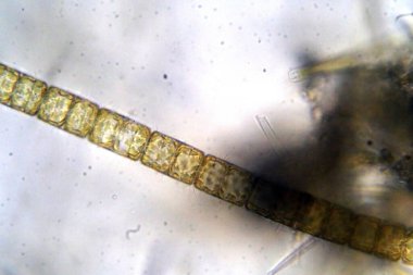 Mikroskobik Yaşam. Mikroskop. Tek hücreli hayvan. Yaşayan organizma. Mikroskopla bakıldı. Hayvan Hayatı. Mikroskobik Rotifer ya da Rotifera mikroskop altında, suyu filtreleyen tatlı su bentik organizması. Mikroskop ile görülebilen mikroskobik yaşam. 