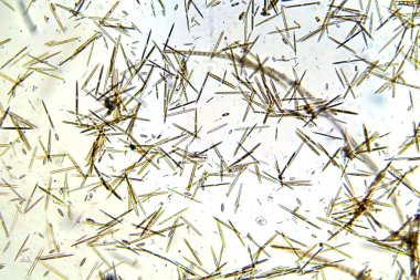 Mikroskobik Yaşam. Mikroskop. Tek hücreli hayvan. Yaşayan organizma. Mikroskopla bakıldı. Hayvan Hayatı. Mikroskobik Rotifer ya da Rotifera mikroskop altında, suyu filtreleyen tatlı su bentik organizması. Mikroskop ile görülebilen mikroskobik yaşam. 