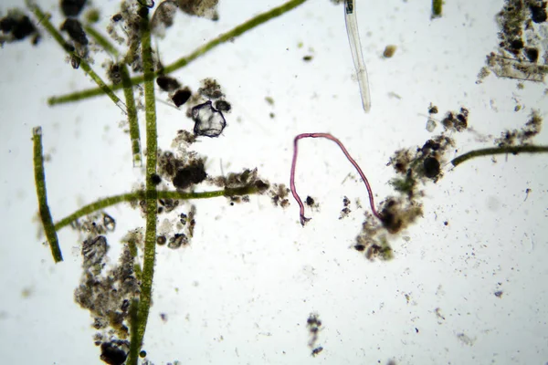 Mikroskopiskt Liv Mikroskop Ensamstående Celldjur Levande Organism Sett Genom Ett — Stockfoto