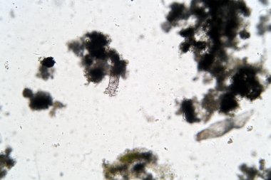 Rotifer is a Microscopic animal living in stagnant fresh pond water. Scientific names included keywords. Seen and photographed through a biological microscope and DSLR camera with a special adaptor.