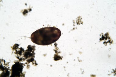 Microscopic freshwater Ostracod aka seed shrimp seen through a Microscope at 100 times its actual size. Taken from a local duck pond of fresh water. Scientific names included keywords.