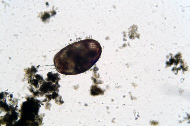 Microscopic freshwater Ostracod aka seed shrimp seen through a Microscope at 100 times its actual size. Taken from a local duck pond of fresh water. Scientific names included keywords.