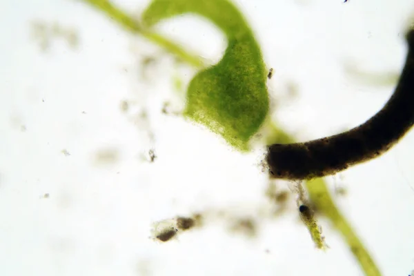 Microscopic animals in stagnant fresh pond water. Scientific names included keywords. Seen and photographed through a biological microscope and DSLR camera with a special adaptor.