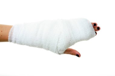 Alçıdaki İnsan Eli. Kumaş bandajlı insan eli. Bir insanın eli bandaja sarılı. Bandaj, bilekten parmak uçlarına kadar tüm eli kaplayacak şekilde elin etrafına sarılmış. Sağlık ve Sağlık Hizmetleri. Hastane ziyareti. 