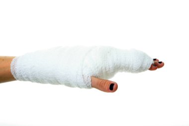 Alçıdaki İnsan Eli. Kumaş bandajlı insan eli. Bir insanın eli bandaja sarılı. Bandaj, bilekten parmak uçlarına kadar tüm eli kaplayacak şekilde elin etrafına sarılmış. Sağlık ve Sağlık Hizmetleri. Hastane ziyareti. 