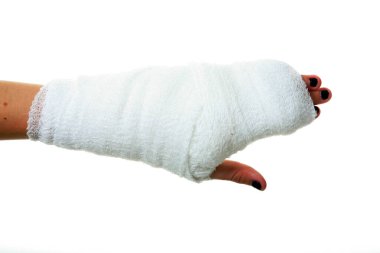 Alçıdaki İnsan Eli. Kumaş bandajlı insan eli. Bir insanın eli bandaja sarılı. Bandaj, bilekten parmak uçlarına kadar tüm eli kaplayacak şekilde elin etrafına sarılmış. Sağlık ve Sağlık Hizmetleri. Hastane ziyareti. 