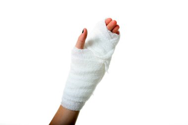 Alçıdaki İnsan Eli. Kumaş bandajlı insan eli. Bir insanın eli bandaja sarılı. Bandaj, bilekten parmak uçlarına kadar tüm eli kaplayacak şekilde elin etrafına sarılmış. Sağlık ve Sağlık Hizmetleri. Hastane ziyareti. 