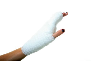 Alçıdaki İnsan Eli. Kumaş bandajlı insan eli. Bir insanın eli bandaja sarılı. Bandaj, bilekten parmak uçlarına kadar tüm eli kaplayacak şekilde elin etrafına sarılmış. Sağlık ve Sağlık Hizmetleri. Hastane ziyareti. 