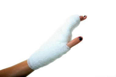 Alçıdaki İnsan Eli. Kumaş bandajlı insan eli. Bir insanın eli bandaja sarılı. Bandaj, bilekten parmak uçlarına kadar tüm eli kaplayacak şekilde elin etrafına sarılmış. Sağlık ve Sağlık Hizmetleri. Hastane ziyareti. 