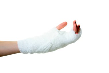 Alçıdaki İnsan Eli. Kumaş bandajlı insan eli. Bir insanın eli bandaja sarılı. Bandaj, bilekten parmak uçlarına kadar tüm eli kaplayacak şekilde elin etrafına sarılmış. Sağlık ve Sağlık Hizmetleri. Hastane ziyareti. 