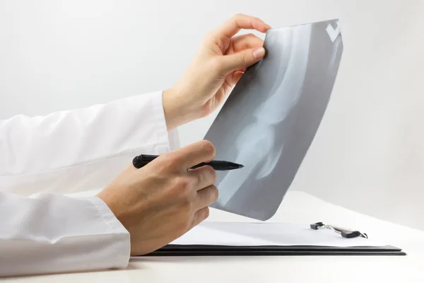 Medico con appunti medici che analizza roentgen gamba ginocchio o radiografia radiografica Foto Stock