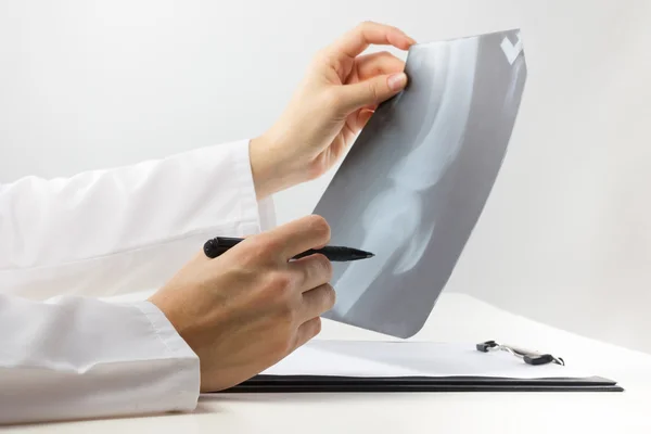 Healthcare and medicine concept - doctor with medical clipboard analyzing leg knee roentgen or x-ray radiography examination. — 스톡 사진