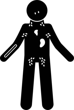 Hodgkin olmayan lenfoma lenf kanseri semptomları Risk Faktörleri Diagnosis Çubuğu Şekil Resim Simgelerine neden oluyor