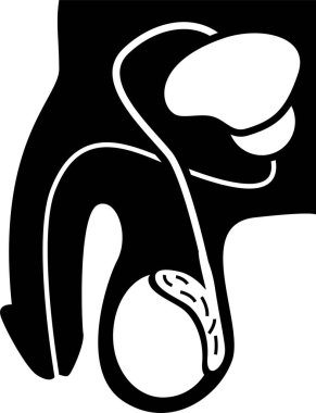 Testis Testleri Kanser Semptomları Risk Faktörleri Teşhis Çubuğu Resim Simgelerine neden olur