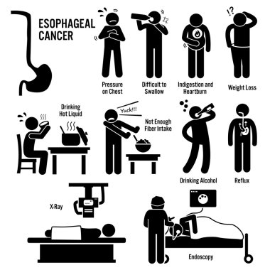 Esophageal Esophagus Kanser Semptomları Risk Faktörleri Teşhis Etme Çubuğu Resim Simgeleri