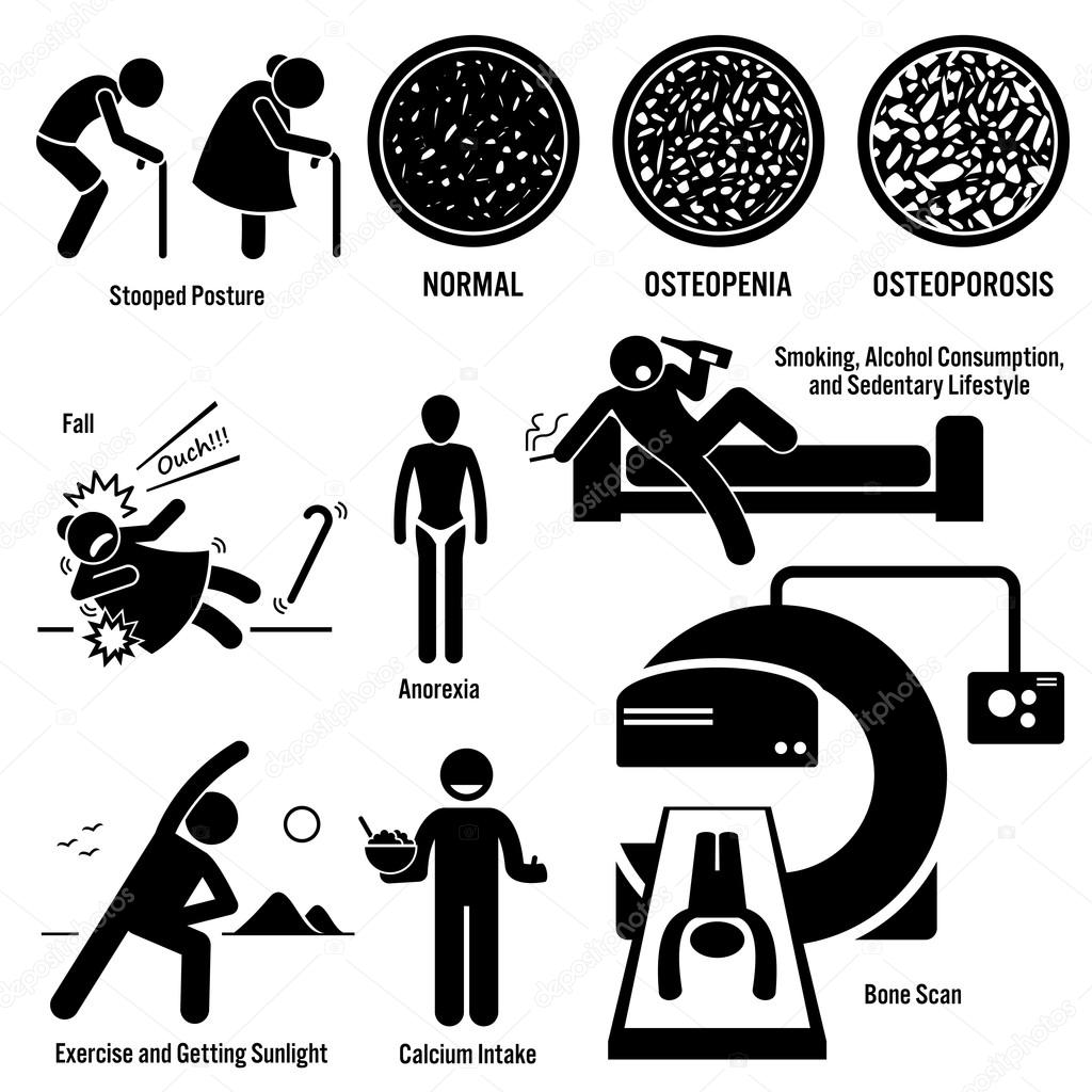Osteoporosis Old Man Woman Symptoms Risk Factors Prevention Diagnosis Stick Figure Pictogram Icons