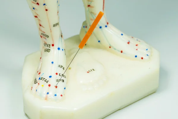 Acupuncture demonstration on feet model — Stock Photo, Image