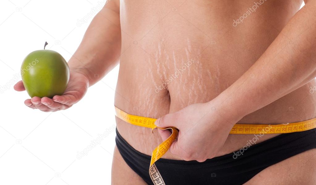 stretch marks and cellulite,concept of healthy life