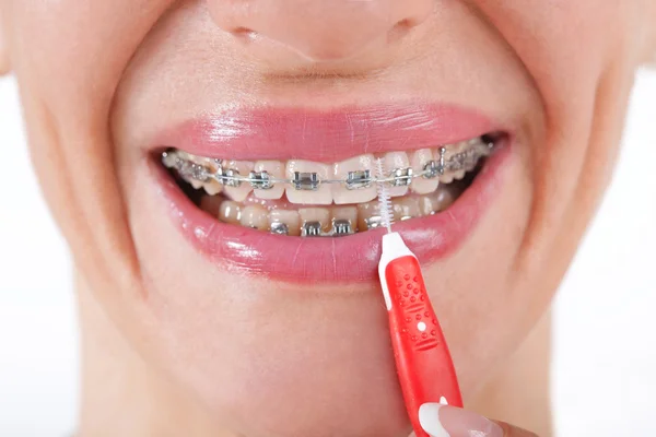Νεαρή γυναίκα με τιράντες βουρτσίζετε τα δόντια της — Φωτογραφία Αρχείου