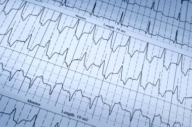 Elektrokardiyogram şeması, kapatın.