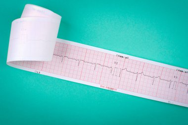 Yeşil arkaplanda ECG