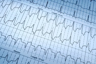 arkaplan olarak kağıt üzerinde kardiyogram