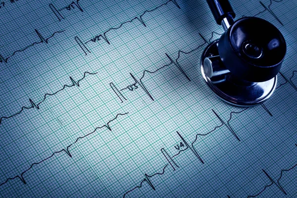 Estetoscópio Eletrocardiograma Ecg — Fotografia de Stock