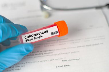 Üzerinde kan olan bir örnek şişesi. Etikette koronavirüs testi olduğu yazıyor. Covid 19 salgın konsepti