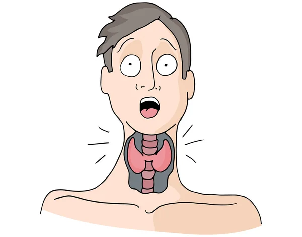 Thyroid Medical Condition Man — Stock Vector