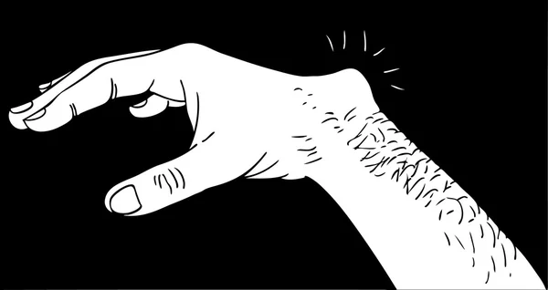 Kyste ganglionnaire — Image vectorielle