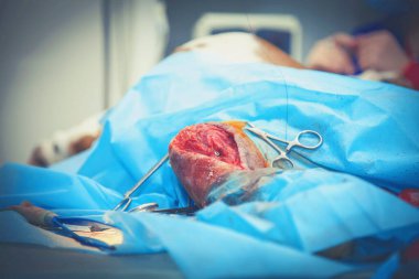 Hayvan hastanesindeki köpek. Ameliyat sırasında köpek dişi. Ön çapraz yırtılma. Bacağa çift osteotomi yapılmış. (Sağlık, hayvan, hastane, tedavi, tıp konsepti)