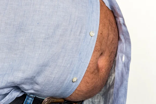 Człowiek z nadwagą — Zdjęcie stockowe