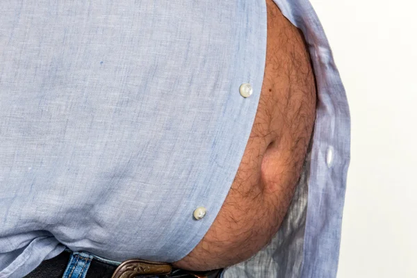 Man with overweight — Stock Photo, Image