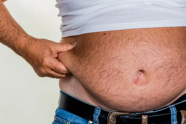 Hombre con sobrepeso — Foto de Stock