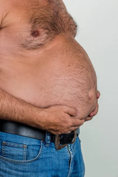 Man with overweight — Stock Photo, Image