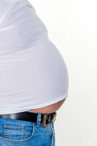 Man with overweight — Stock Photo, Image