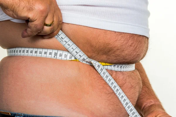 Man with overweight — Stock Photo, Image