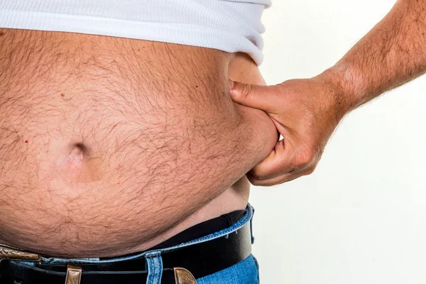 Man with overweight — Stock Photo, Image